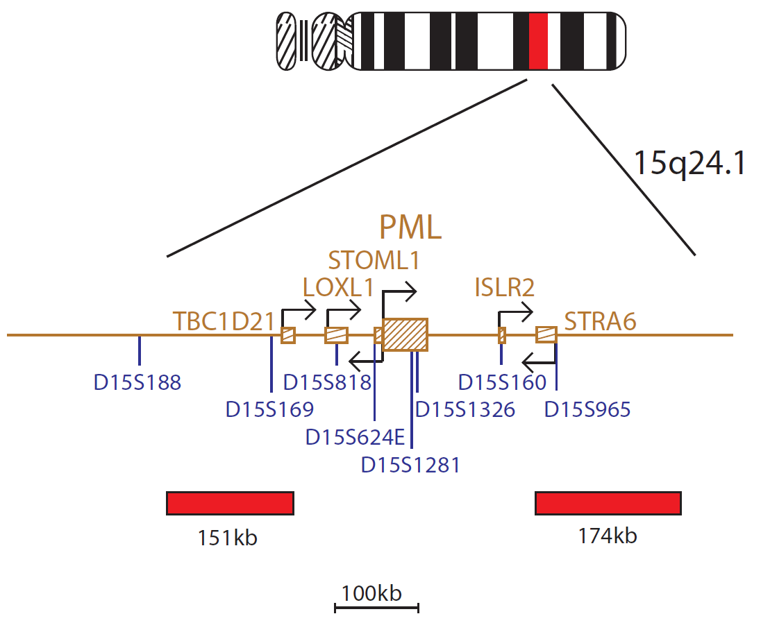 PML / RARA FAST Translocation