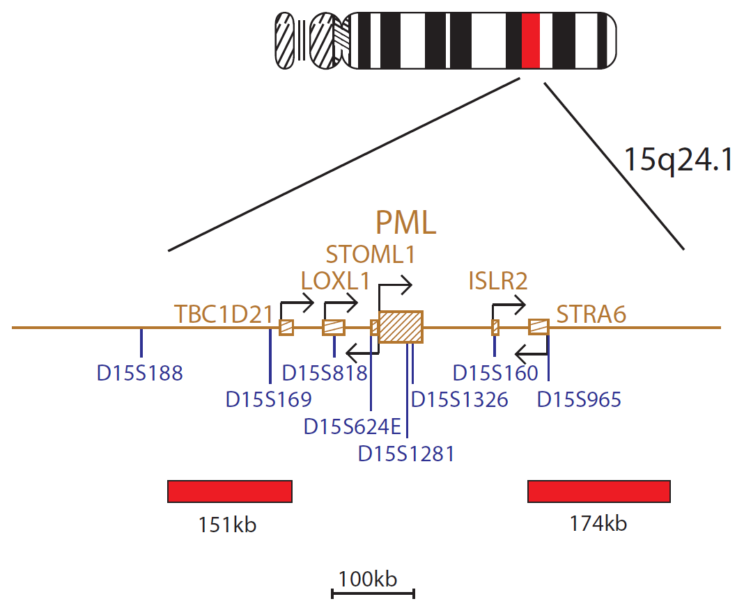 PML / RARA Translocation