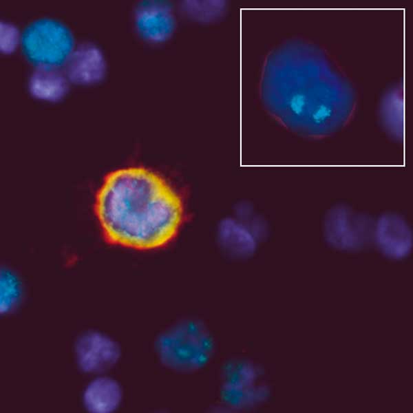 Rare Events Automated Detection of Rare Cells