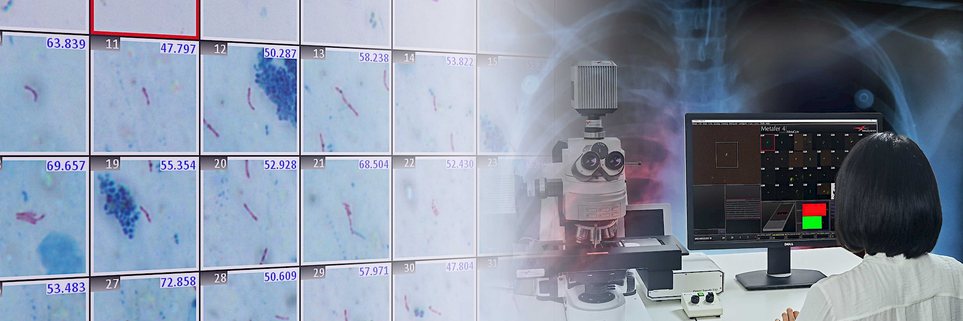 Finding Mycobacteria