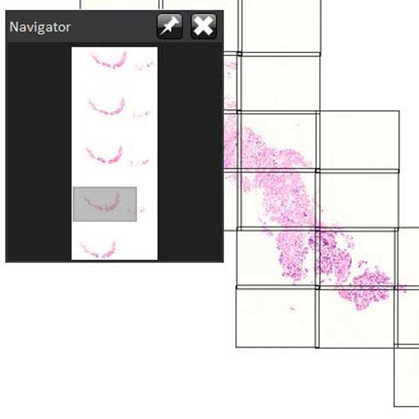 Tissue Imaging Sample Digitization, Analysis, and Sharing