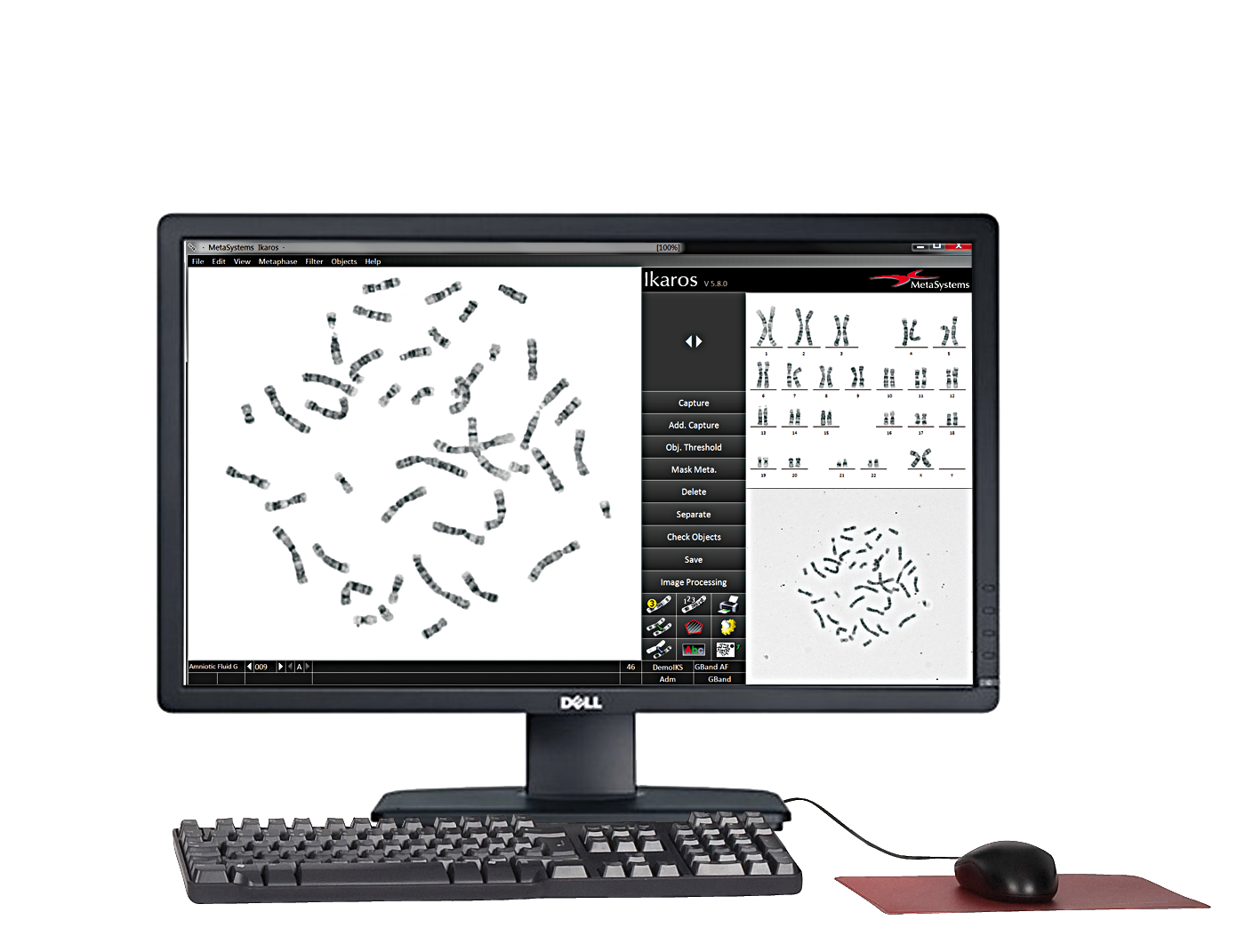 MetaSystems IKAROS FISH ve Karyotip Manuel Capture ve Analiz  Sistemleri